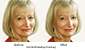Middle-aged Before and After Thumbnail
